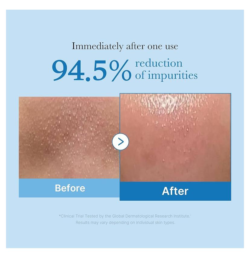 medicube Aceite limpiador de puntos negros Zero Pore